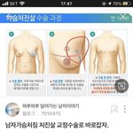 [19] 가슴 너무 <b>처짐</b>ㅠㅠㅠㅜㅜㅜ