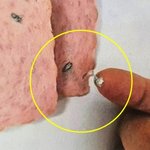 고등학교 급식 햄에서 ‘돼지 지혈약’ 나왔다