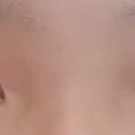 복코 <b>얄쌍</b>하게 만들려면 수술 뭐해야해??