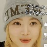 <b>홍은채</b> 보톡스 맞음?