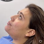 와 <b>비포</b>애프터 ㄹㅈㄷ