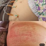 피부.성형 부작용N리뷰가 <b>명예</b>훼손인가요? 보고 판단해주세요ㅜㅜ