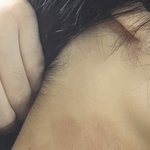 [댓글부탁해] 혐..?) 목<b>아토피</b>인가