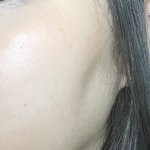 옆광대+볼패임 관리 어떻게해?