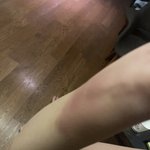 [이것좀봐줘] 이거 멍<b>자국</b> 누가 잡아서 생긴거 맞지?