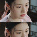 [댓글부탁해] <b>돌출입</b> 교정이랑 콧볼축소 하면