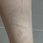 이거 병원 <b>가야</b>할 것 같애???