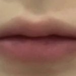 [댓글부탁해] 입술필러 맞고 고래 잡은 썰(입술필러 부작용/입술필러...