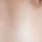 [댓글부탁해] 쌍꺼풀 <b>수술</b> 앞트임
