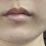 나 눈이 하관 커버 가능한 수준임?