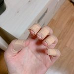 큐티클 정리하다가 손가락 피남