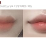 [댓글부탁해] 입술<b>필러</b> 맞을까