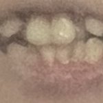 나 전에 치열로 톡<b>선간</b> 앤데 기억할려나