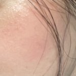 이 <b>정도</b>면 <b>피부</b> 몇 호일까??