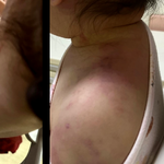 [방탈죄송] 아이가 어린이집에서 학대를 당했습니다.도와주세요.