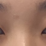 [댓글부탁해] 렌즈 <b>개눈</b> 같아??