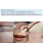 [방탈죄송] 안산 어린이집 추가 아동학대 피해자 엄마입니다.