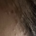 와 나 여드름 개<b>극혐</b>인데 볼사람