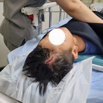 [이게맞냐] 어린이집 안전사고