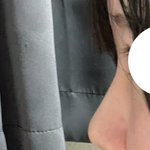 [댓글부탁해] <b>코</b> 세울까? 어떻게 생각함