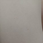 몸에 빨간점 나는거 머임??ㅠㅠ