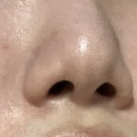 [댓글부탁해] 나 내일 코수술하러<b>감</b>