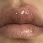 헤르페스 있는사람 제발 들어와줘ㅠㅠ