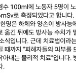 <b>방사능</b>이 피부에묻은 일본인 근황