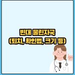 이제 서울에서까지 <b>빈대</b>발견..<b>빈대</b>물린자국과 예방법확인해보세요.