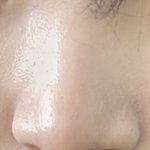 [ㅈㄱㄴ] 나 코 성형 할까 말까