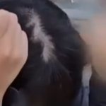 진지하게 이거 탈<b>모임</b>??
