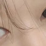 쌍수 <b>티나</b>??