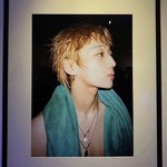 <b>매부리</b> 생기는 방법은 없음?