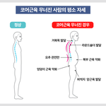나 말랐는데 아랫배만 나와서 뭐가 문제지 했는데