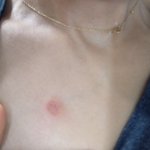 이게 무슨 <b>피부병</b>인지 좀 봐주세요