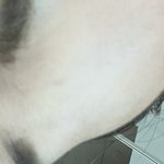 [19] 나 이 정도면 <b>이마</b>까짐