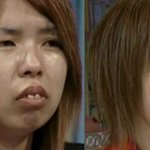 일본연예인 성형 <b>전후</b> 라는데