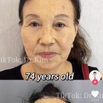 요즘 <b>틱톡</b>에 이런 성형 ㅈㄴ뜨는데