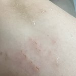 이거 <b>빈대</b>자국임????