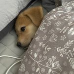 절개 <b>쌍수</b> 하고 알바가능함?…