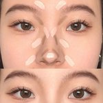 와 등<b>드름</b> 자연적으로 없어짐