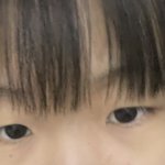 [이거보고가] <b>쌍수</b> 한다 vs 안한다