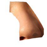 피부 이거 어떻ㄱㅔ 없앰