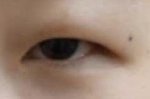 나 쌍수할건데 트임 뭐뭐 할까