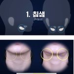 [다이어트] 시술없이 턱살 없애는법 +(<b>이중턱원인</b>)