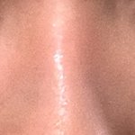 휜코&amp;매<b>부리</b>코 쉐딩 비포 에프터