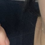 나 여잔데 얼굴에 완전 긴 털이 났어……..