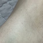 약혐) 나 피부에 빨간<b>점</b> 이거 뭘까..?????