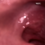 [<b>병원</b>] 목 조카 부었는데 어케