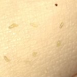 혐주의)얼굴 피부에 맨날 <b>딱딱</b>한 피지 생겨ㅜㅜ